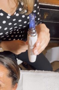 My First Microneedling Experience